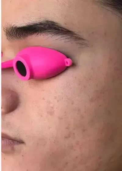 After Treatment